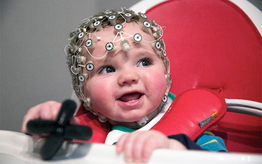 Как делают ЭЭГ головного мозга ребенку